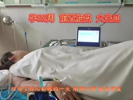 孕32周,前置胎盘,大出血……前置胎盘太危险,怀孕生娃真的不容易,愿小孕妇们都能够母子平安🙏🏻🙏🏻🙏🏻 #快点好起来 #怀孕日记 #人世间 #坚持就是胜利 #医院🏥