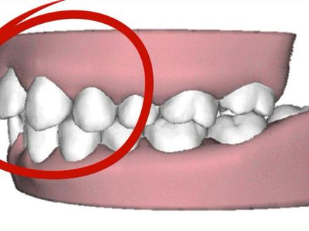 小朋友长期吐舌头对牙齿不好哟#牙齿健康 #吐舌头