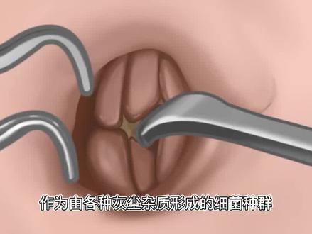 肚脐眼里的“泥”究竟是啥,能不能抠?显微镜下放大1000倍现原形03