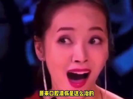 原来治口腔溃疡要以毒攻毒 在座各位都是个狠人 #口腔溃疡 #冷知识 #健康 #娱乐评论大赏
