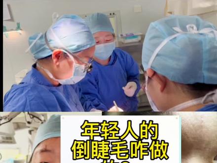 年青人有内眦赘皮的倒睫毛手术。#倒睫毛 #眼科医生马晓萍 #干眼茶馆 #倒睫 #角膜炎 @DOU+小助手
