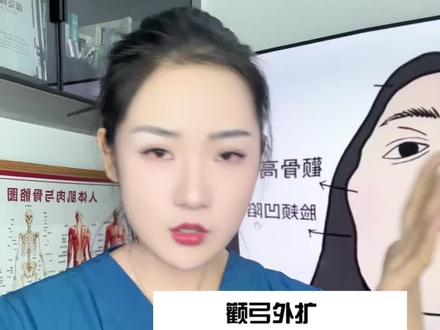 颧骨终结者来了 高颧骨统统闪开#面部矫正 #颧骨