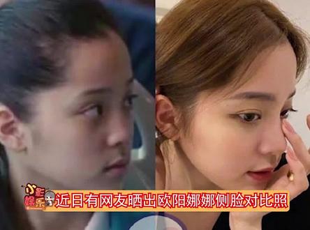 欧阳妮妮否认欧阳娜娜整过鼻子,大家真的很爱说故事,当姐姐的都不知道#娱乐播报台