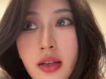 治愈。进食障碍。暴饮暴食。上