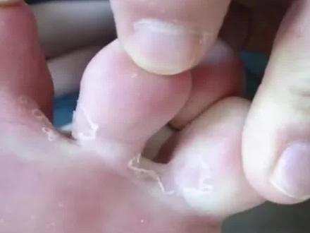 宝宝也会有脚气,特别是家长就有的#脚气 #宝宝 #育儿