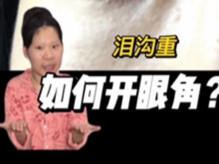 内眦赘皮如何开眼角?有没有同款眼睛的姐妹!!
#开眼角 #干货分享 #内眦赘皮 #妆教 #挑战100天成为美妆博主 @抖音小助手 @DOU+小助手