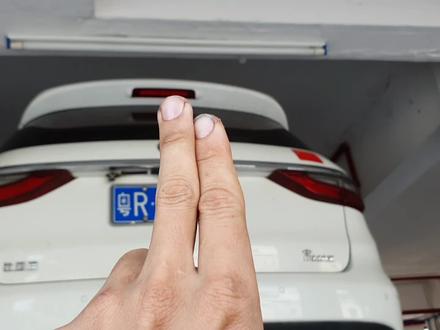 #自动变速箱 #比亚迪 比亚迪 宋max 故障现象起步抖动,转弯抖动,波箱大修