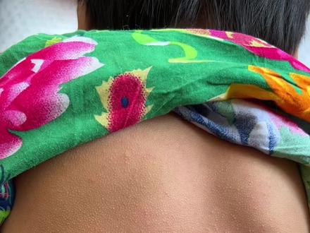 千万别相信这些猪毛风!只会伤害孩子的皮肤