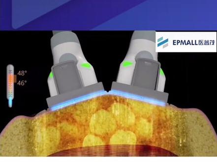 #减肥#轰脂@这里是南京