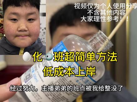 淡班超级简单小技巧,上岸版!大家理性参考噢~#雀斑#黄褐斑#护肤#真实生活分享计划#上热门