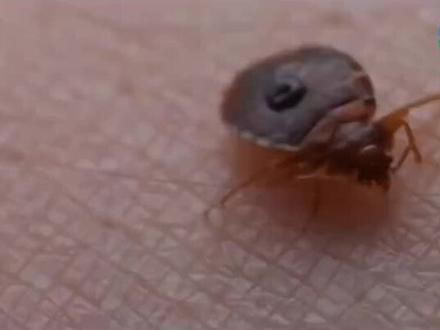 @安泰四害消杀
一起学习一下臭虫的习性。
#臭虫消杀#四害消杀#臭虫药