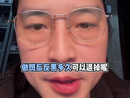 祛斑后反黑多久可以退掉