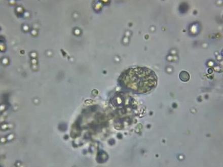 显微镜观察之黏菌如何进食 #显微镜 #显微镜下的世界 #微观世界 #黏菌 #黏菌吃麦片