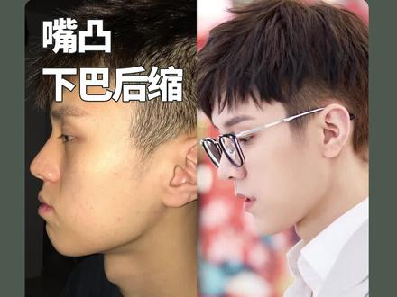 呼吸变美技巧,男人追着你跑!#骆王宇干货day
