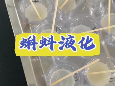 蝌蚪液化#微观世界 #男性 #男性保养 #男性不育