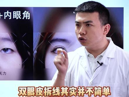 双眼皮拆线其实并不简单,并不是所有科室都能拆线。#成都双眼皮林威 #双眼皮拆线 #医学科普