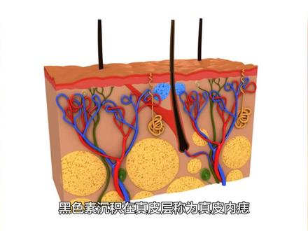 你所不知道的“北斗七星痣”的秘密 #身上有北斗七星痣 #身上有痣