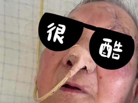 佩戴说话瓣膜,成功让80岁气管切开老人重新发声#宁波市康复医院 #神经康复科 #气切 #康复训练
