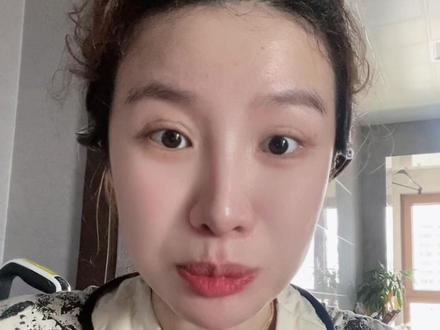 孕期感冒发烧甲流支原体细菌感染新冠都是可以用药的,先去医院确定是哪一种类型,查血项看偏高多少。多问几个医生后遵医嘱,我发烧的时候胎心都快180了,在家挺更容易影响孩子。#日常唠嗑 #孕期vlog