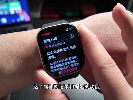心脏房颤功能正式上线国内苹果手表,教你如何打开! #applewatch #苹果 #苹果房颤功能 #数码科技