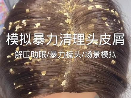 场景模拟 模拟暴力清理头皮屑
#场景模拟 #声控助眠