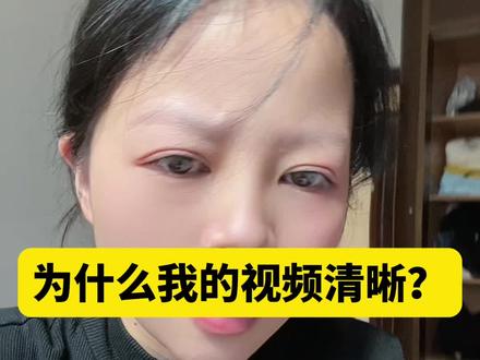 我的视频清晰度参数设置