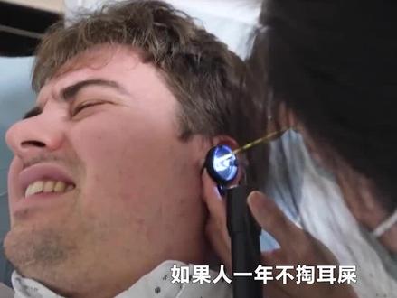 如果人连续一年不掏耳屎会怎样?真的会聋吗?结果可能颠覆想象(1)