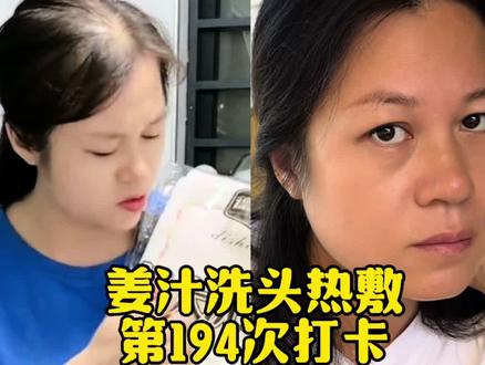 姜汁洗头热敷第194次打卡#记录我的生活