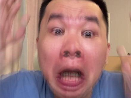 牢A揭露了美国蛋白粉的秘密 #牢A #蛋白粉 #进口牙 #种植牙 #蛋白粉原料