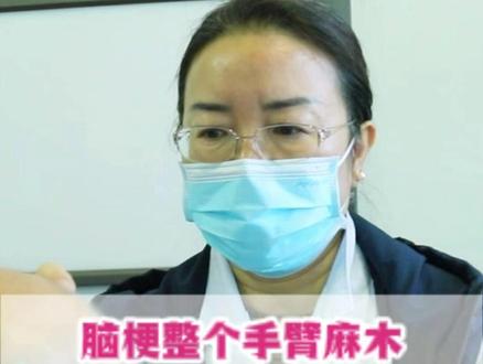 脑梗整个手臂麻木,扎完针当时就好了一大半 #脑梗 #宣武医院徐敏医生 #神经内科 #脑梗后遗症 #中医