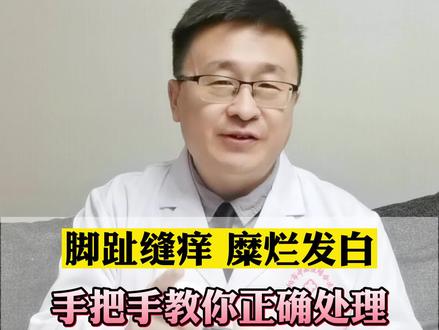 脚趾缝总是湿湿的,糜烂发白还很痒,试试这样做!#脚气 #咪康唑散 #皮肤 #脚痒 #科普