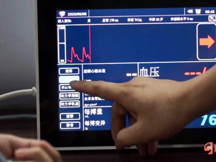 T-Line系列操作步骤#无创血流动力学监测 #操作步骤#医疗器械 #医疗机构 #医疗科普 #我要上热门