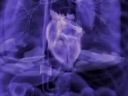 11岁女孩罕见心脏移位,患四种心脏病,医生能否妙手回春?