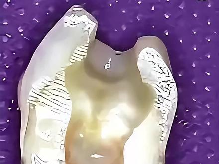 #口腔医学 #口腔 #活髓切断术 #口腔实验室 第一视角看活髓切断术👀