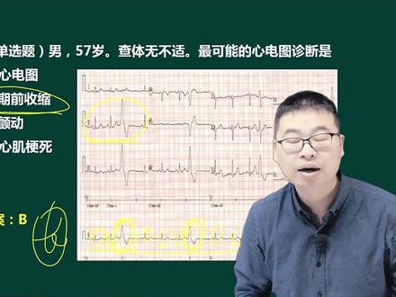 跟着三毛老师做题,心电图拿满分! #技能培训 #临床医学 #执业医师考试