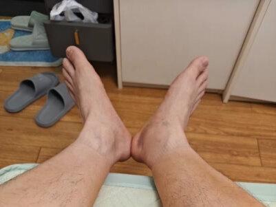 40岁经历腓肠肌撕裂#腓肠肌撕裂