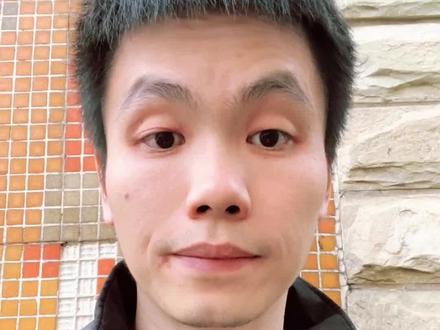 汉坦病毒已导致多人死亡,会不会出现大流行?普通人应该怎么办? #中疾控回应汉坦病毒疫情 #汉坦病毒 #抖出健康知识宝藏