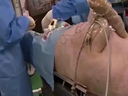 日本圈养大批“半人半猪”,体内长着人体器官,理由竟是救人命#科普 #涨知识 #内容启发搜索