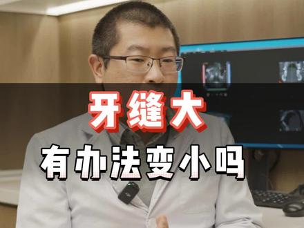 牙缝大,有什么方法可以变小吗? #补牙 #健康科普