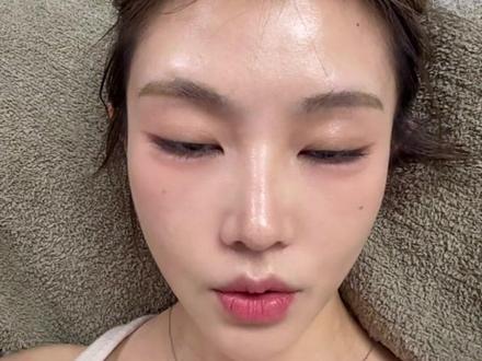 面中凹陷和鼻基底凹陷完全不同,别搞错了 #避坑 #变美