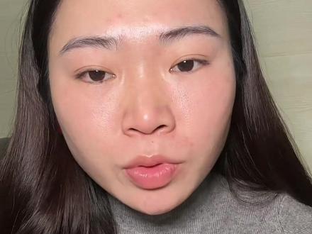 #每日分享 激光祛斑反黑修复