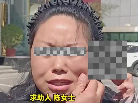 2万多整形,好好的脸全毁了!#变美