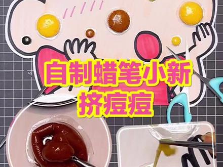 自制蜡笔小新挤痘痘,超解压