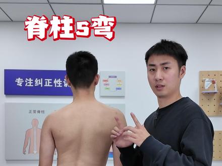 脊柱s弯,胸右凸腰左凸,改善动作分享 #体态纠正 #高低肩 #骨盆倾斜 #脊柱侧弯