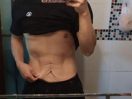 说说关于像我这样的大基数减下来皮肤松弛的问题,我没有发言权大佬职业选手总有发言权了吧?#减肥 #皮肤松弛 #减脂 #内容过于真实 #努力变成你想要的样子