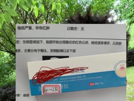 #痘痘 目前这种营销方式非常流行,大家一定要警惕。