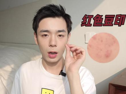 抗炎7天有多牛?纯干货!2步养成健康皮!有广遭雷劈