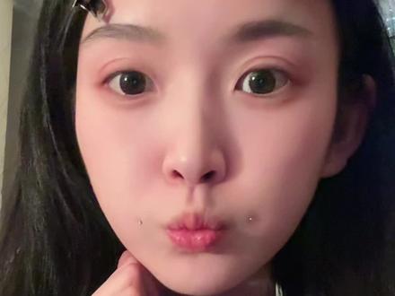 #梨涡钉 梨涡钉去掉了哦~