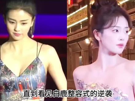 看到白鹿的整容式逆袭,才知道整容并不是普通女孩变美的唯一方式1#娱乐圈#明星#娱乐评论大赏