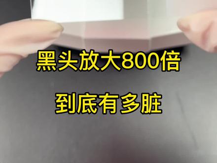#科普 #健康 #黑头
黑头放大,你今天脸部清洁了吗#显微镜下的世界 #实验室日常